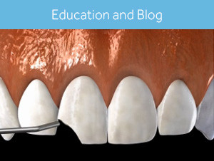 Dental Videos and Blog