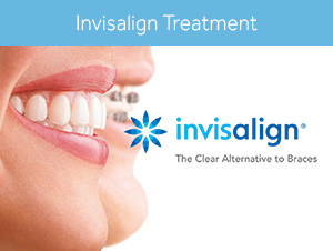 Invisalign Treatment